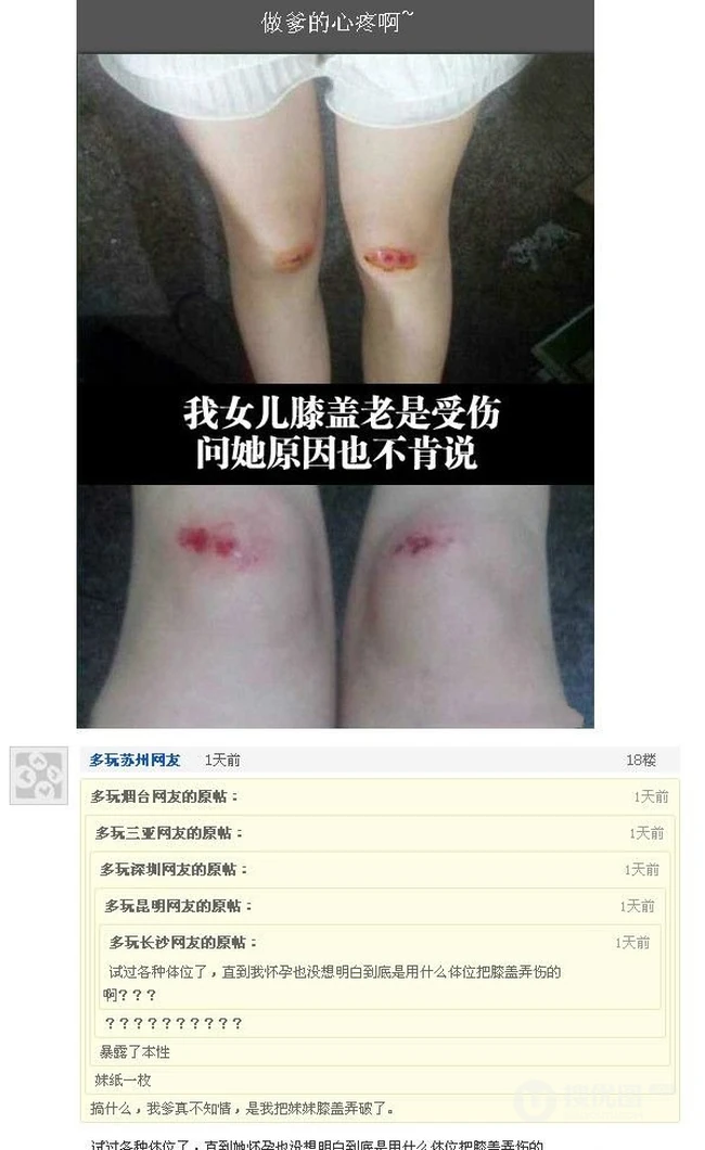 一直没找到原因为什么膝盖会这样