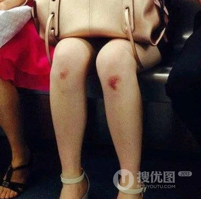 昨天滑了一跤 你信吗？